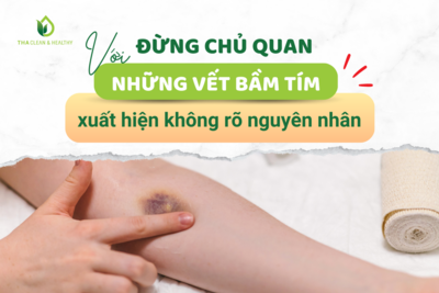 ĐỪNG CHỦ QUAN VỚI NHỮNG VẾT BẦM TÍM XUẤT HIỆN KHÔNG RÕ NGUYÊN NHÂN