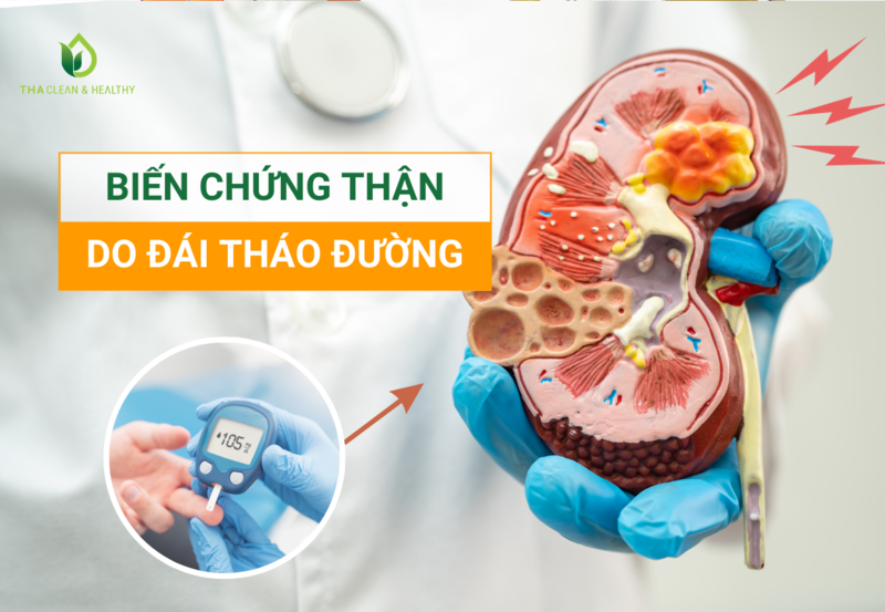 BIẾN CHỨNG THẬN DO ĐÁI THÁO ĐƯỜNG