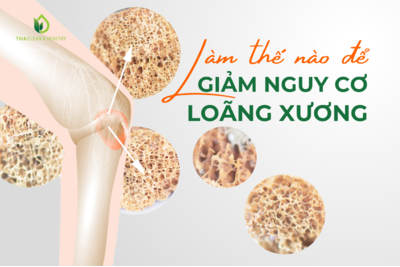 LÀM THẾ NÀO ĐỂ GIẢM NGUY CƠ LOÃNG XƯƠNG