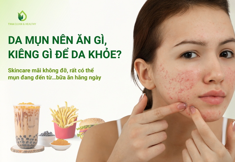 Da mụn nên ăn gì, kiêng gì để da khỏe?