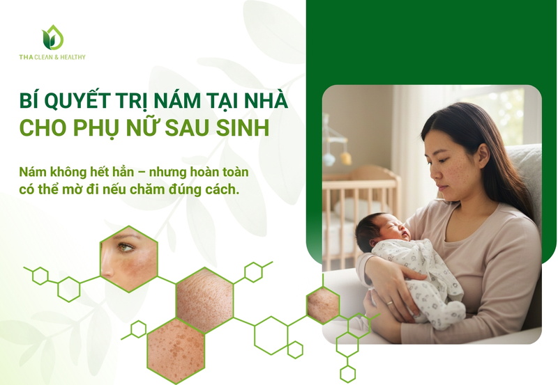 Bí quyết trị nám tại nhà cho phụ nữ sau sinh